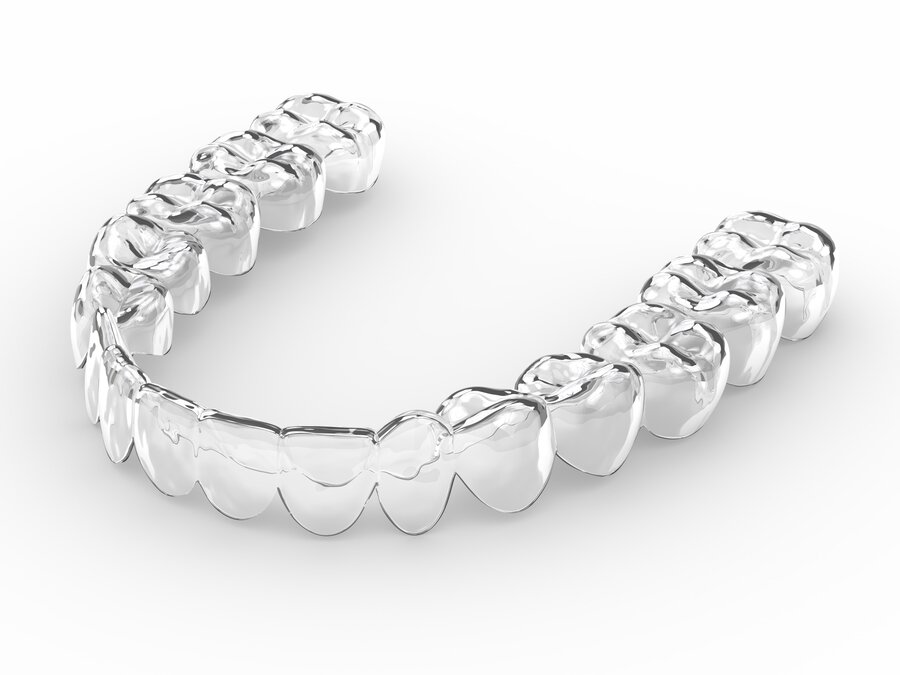 Die Modern Clear Methode - Zahnfehlstellungen unsichtbar korrigieren bei Dr. Sales Köln