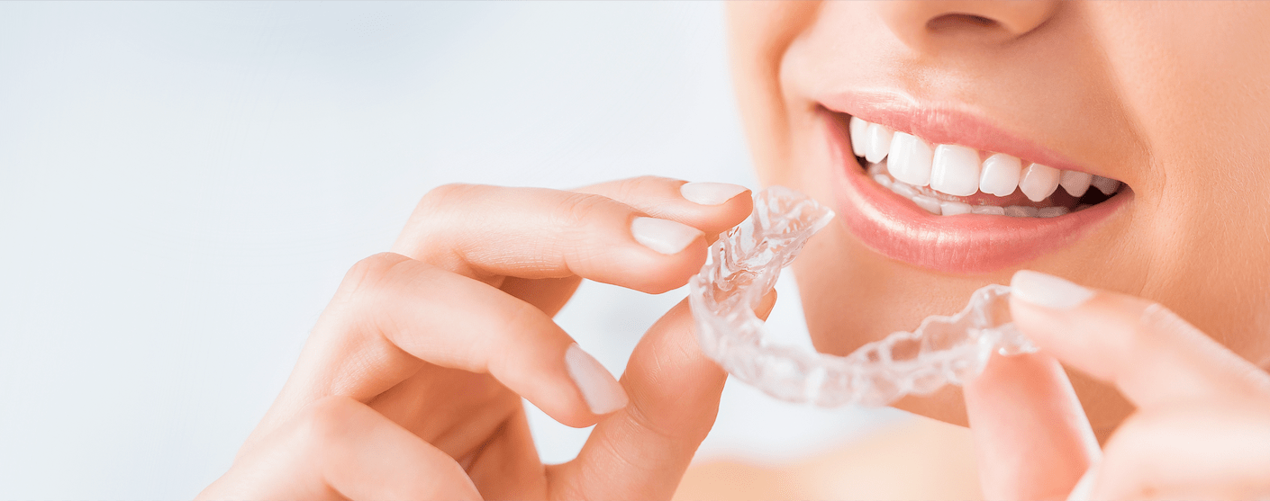 Modern-Clear - die unsichtbare Zahnsstellungskorrektur bei Dr. Sals in Köln Zentrum